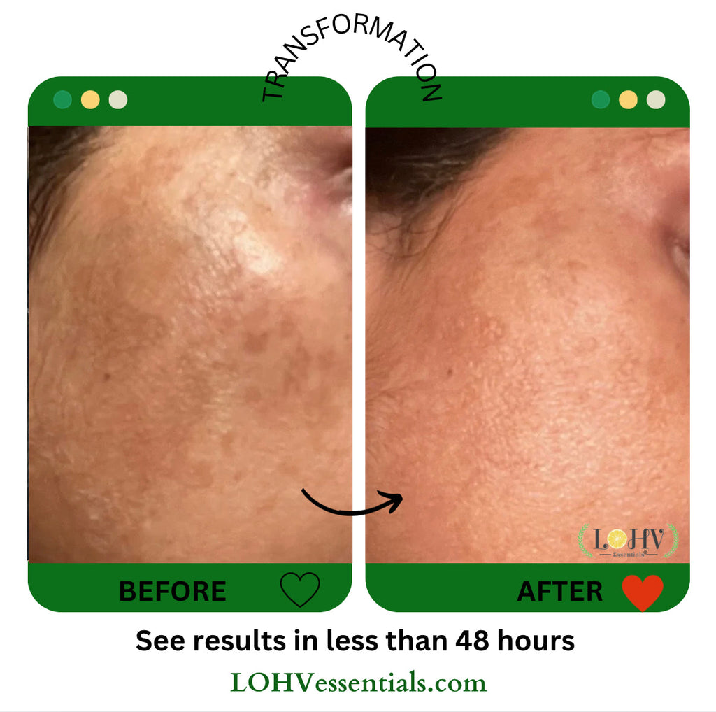 PREMIUM 100% VEGAN GLOW UP Toner Serum With Hyaluronic Acid + Niacinamide + Camellia Leaf + Vitamin E + Rose Water